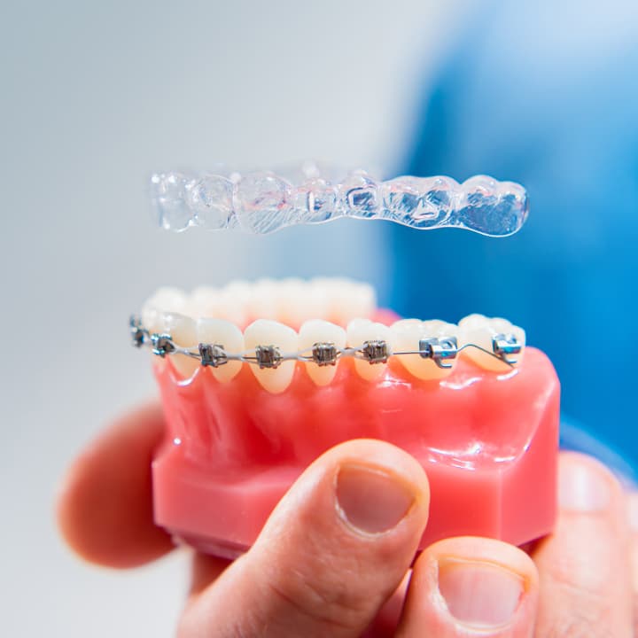 East Bay Dental - Dental Implants, Orthodontist Dentist - Doctor in Fremont, CA