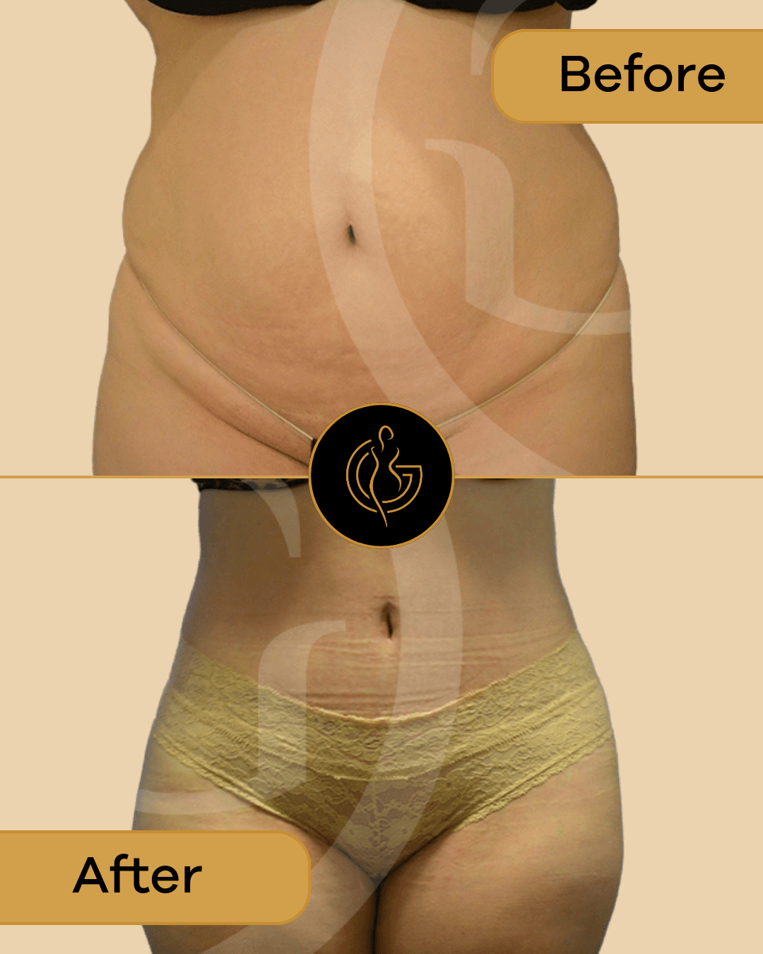 GLOW Surgical Arts - Doctor in Fremont, CA