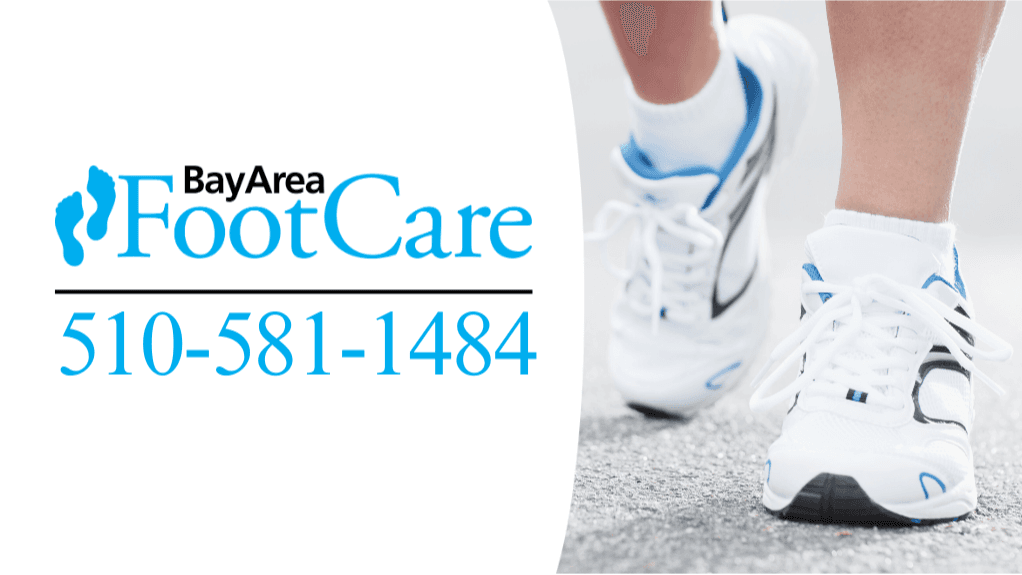 Bay Area Foot Care - Santa Rosa - Doctor in Santa Rosa, CA