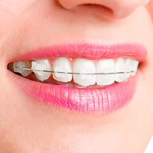 Orthodontic Specialists of Lorain County Inc. - Doctor in Lorain, OH