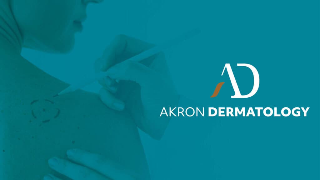 Akron Dermatology - Doctor in Akron, OH