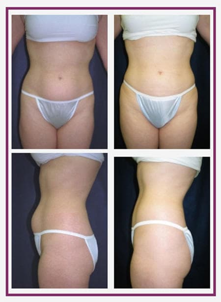 Nashua Plastic Surgery: George P. Chatson, M.D. - Doctor in Nashua, NH