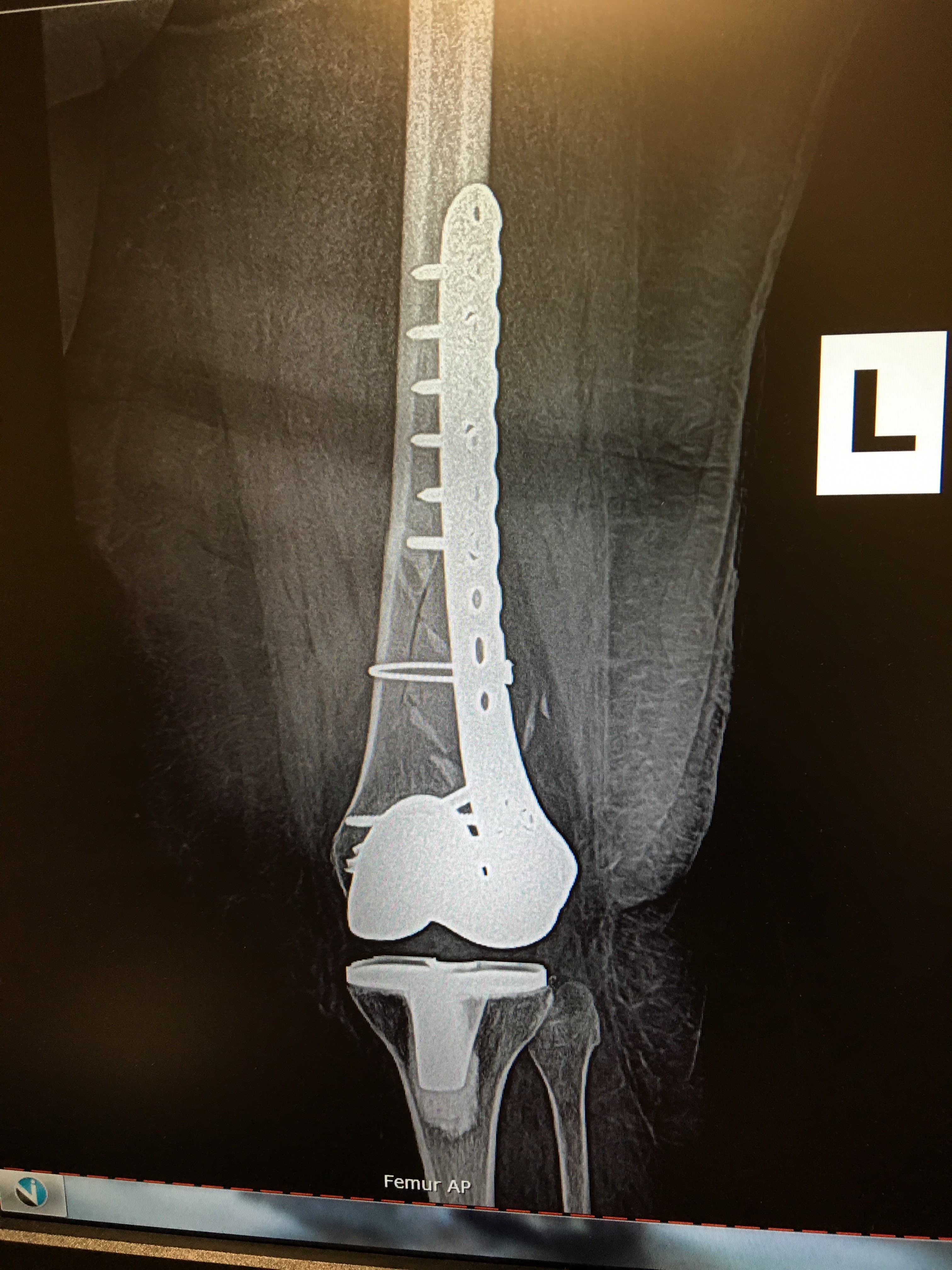 Messieh Orthopedic Clinic - Doctor in Winter Haven, FL